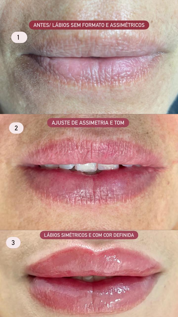 Sequência: lábios assimétricos antes, ajuste de assimetria e tom, lábios simétricos com cor definida